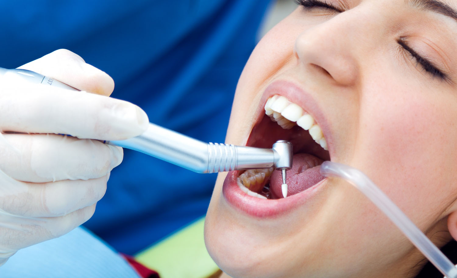Why Teeth Whitening Treatment